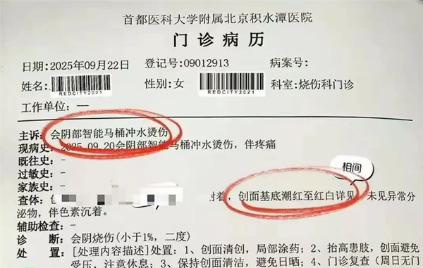 Smart toilet sprays boiling water, scalding woman's intimate area: specific cause under inspection