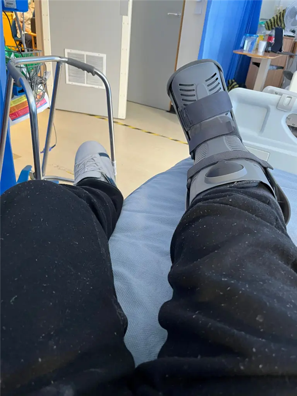 睡梦中被爱犬咬掉一根脚趾！男子选择原谅：称是一场意外