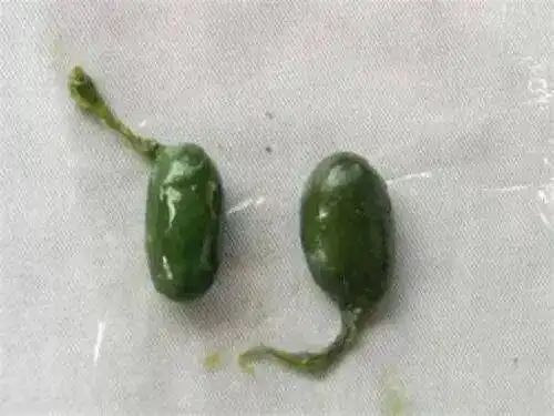 女子生吞鱼胆降火导致肝衰竭 医生:毒性堪比砒霜 无解药