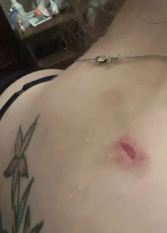 受害者接受治疗（图片来源：网络）