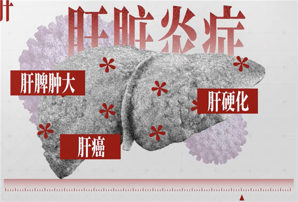 小时候打过的疫苗：背后是一场跨越几代人的公共卫生战役