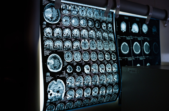 一文看懂：核磁、B超、CT、X光究竟哪个辐射大