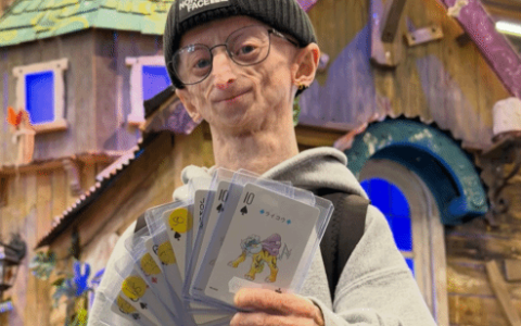 28岁早衰症网红离世，面容苍老已达罕见高龄