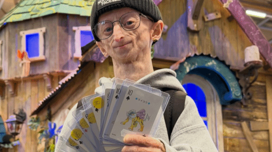 28岁早衰症网红离世，面容苍老已达罕见高龄