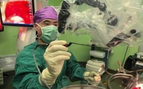 医生边聊天边取出女子脑内7年活虫